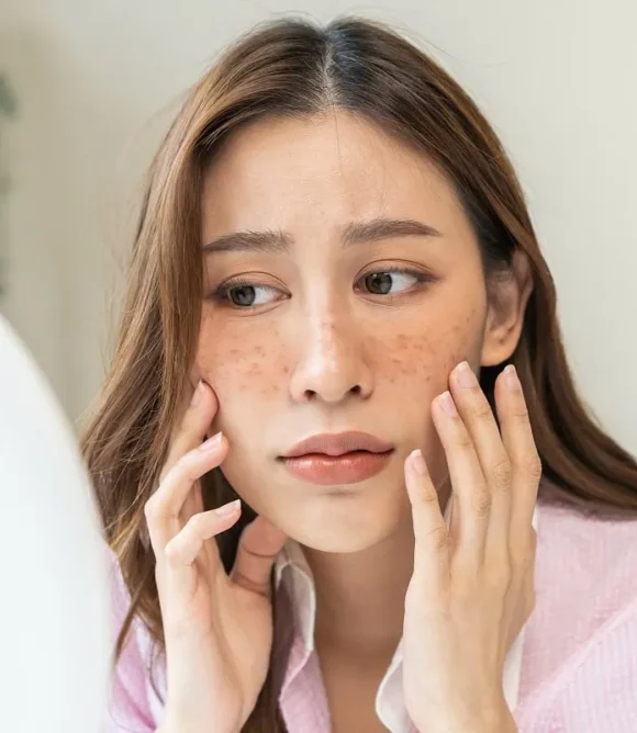 Brown Spots, Sun Damage, and Redness in Elk Grove, CA