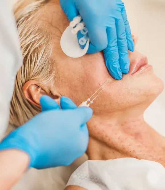 Sagging or Loose Facial Skin in Elk Grove, CA